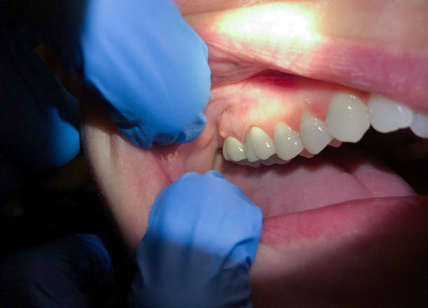 Best Emergency Dental Care for Sports Injuries in Kechi, KS