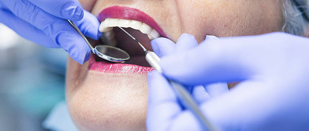 Best Emergency Root Canal Therapy in Kechi, KS