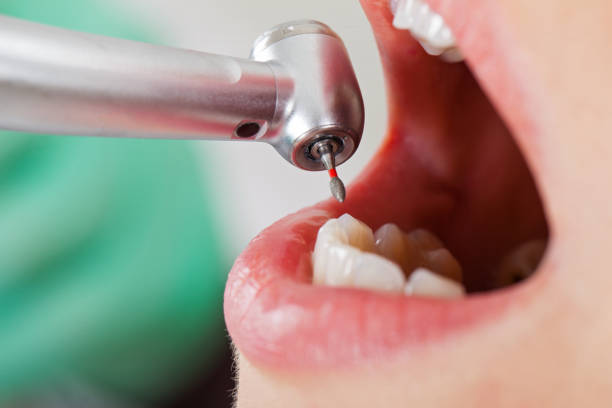 Best Emergency Treatment for Oral Infections in Kechi, KS